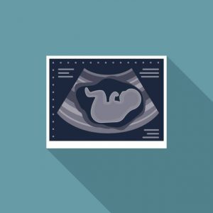 بارداری بعد از سقط 
