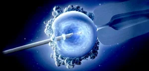 درمان به روش ivf